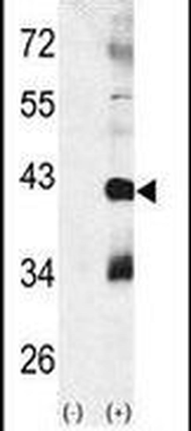 p38 MAPK beta Antibody in Western Blot (WB)