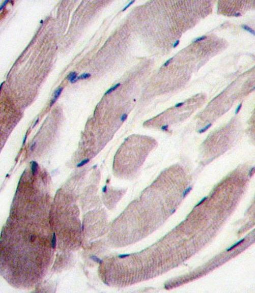 p38 MAPK gamma Antibody in Immunohistochemistry (IHC)