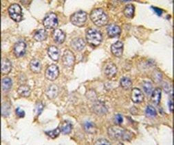 ERK2 Antibody in Immunohistochemistry (IHC)