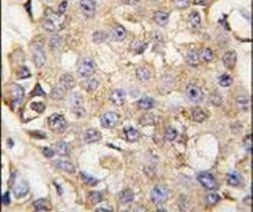 ERK1 Antibody in Immunohistochemistry (IHC)