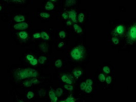 p53 Antibody in Immunocytochemistry (ICC/IF)