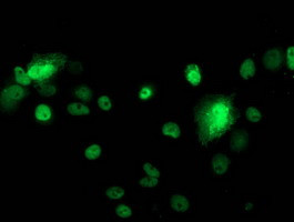 p53 Antibody in Immunocytochemistry (ICC/IF)