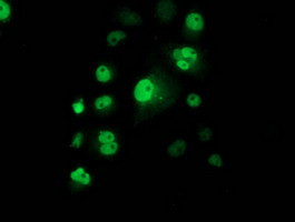 p53 Antibody in Immunocytochemistry (ICC/IF)