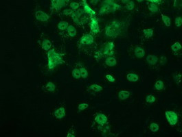 p53 Antibody in Immunocytochemistry (ICC/IF)