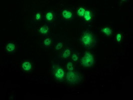 p53 Antibody in Immunocytochemistry (ICC/IF)