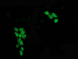 p53 Antibody in Immunocytochemistry (ICC/IF)