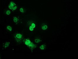 p53 Antibody in Immunocytochemistry (ICC/IF)