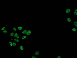 p53 Antibody in Immunocytochemistry (ICC/IF)