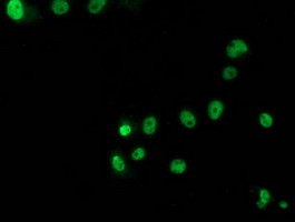 p53 Antibody in Immunocytochemistry (ICC/IF)