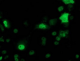 p53 Antibody in Immunocytochemistry (ICC/IF)
