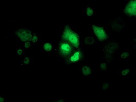 p53 Antibody in Immunocytochemistry (ICC/IF)