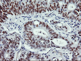 p53 Antibody in Immunohistochemistry (Paraffin) (IHC (P))