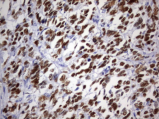 p53 Antibody in Immunohistochemistry (Paraffin) (IHC (P))