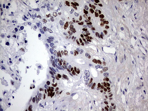 p53 Antibody in Immunohistochemistry (Paraffin) (IHC (P))