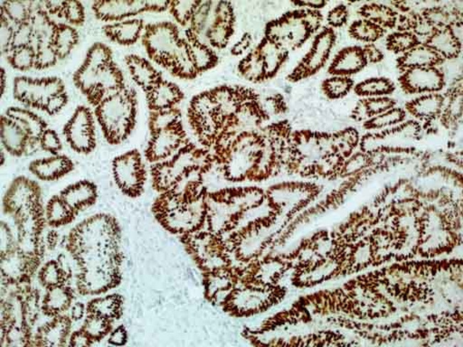 p53 Antibody in Immunohistochemistry (Paraffin) (IHC (P))