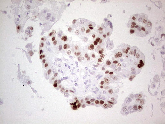 p53 Antibody in Immunohistochemistry (Paraffin) (IHC (P))
