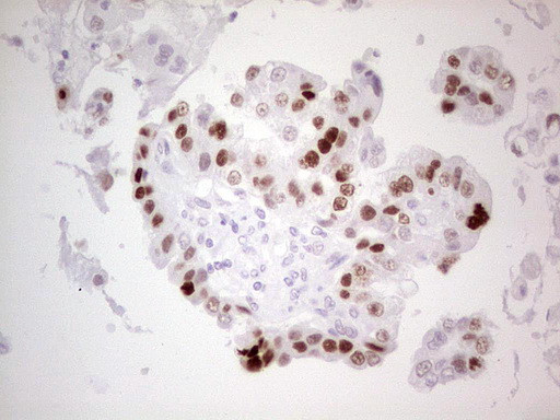 p53 Antibody in Immunohistochemistry (Paraffin) (IHC (P))
