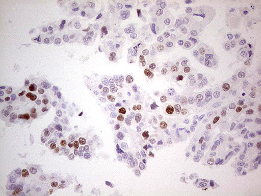 p53 Antibody in Immunohistochemistry (Paraffin) (IHC (P))