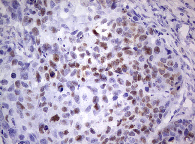 p53 Antibody in Immunohistochemistry (Paraffin) (IHC (P))