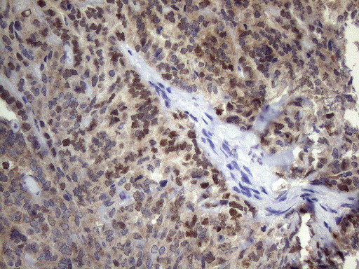 p53 Antibody in Immunohistochemistry (Paraffin) (IHC (P))