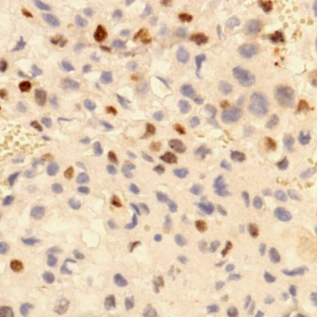p57 Kip2 Antibody in Immunohistochemistry (Paraffin) (IHC (P))