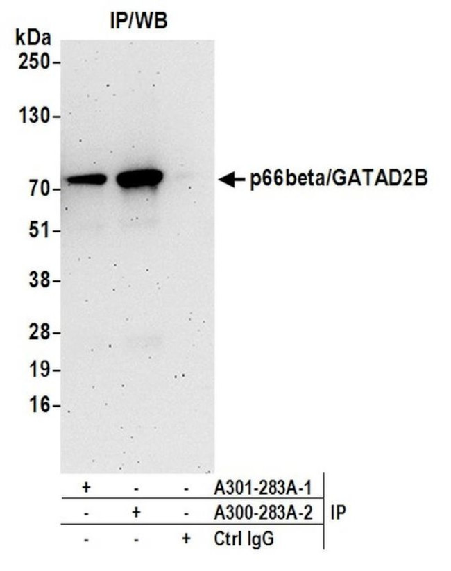 p66beta/GATAD2B Antibody in Immunoprecipitation (IP)