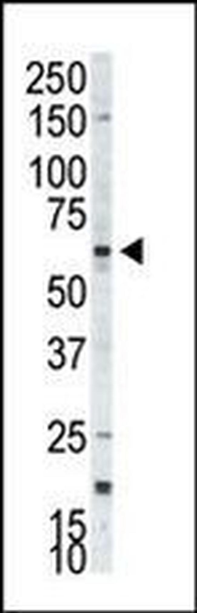 RPS6KB2 Antibody in Western Blot (WB)