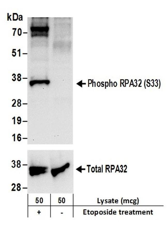 Phospho-RPA32 (Ser33) Antibody in Western Blot (WB)
