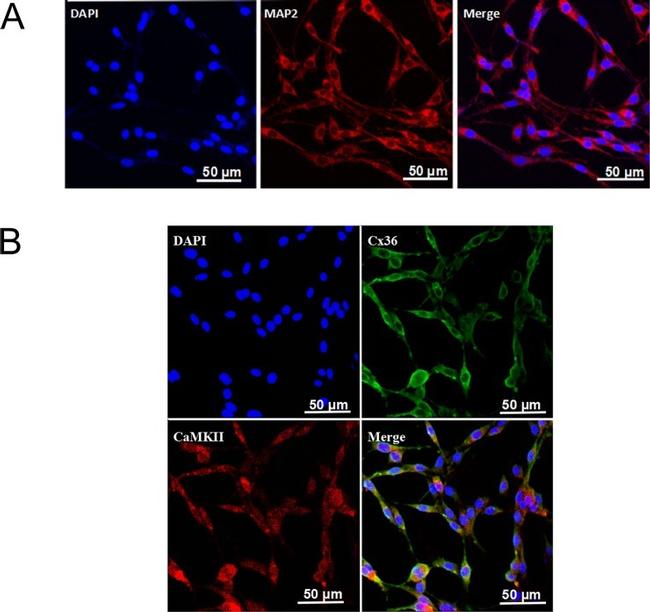 Connexin 36 Antibody in Immunocytochemistry (ICC/IF)