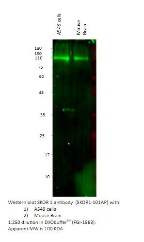 SKOR1 Antibody in Western Blot (WB)