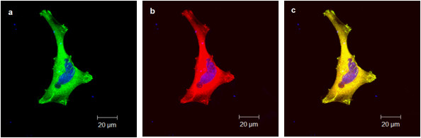 tGFP Antibody in Immunocytochemistry (ICC/IF)
