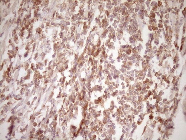 ERBB3 Antibody in Immunohistochemistry (Paraffin) (IHC (P))
