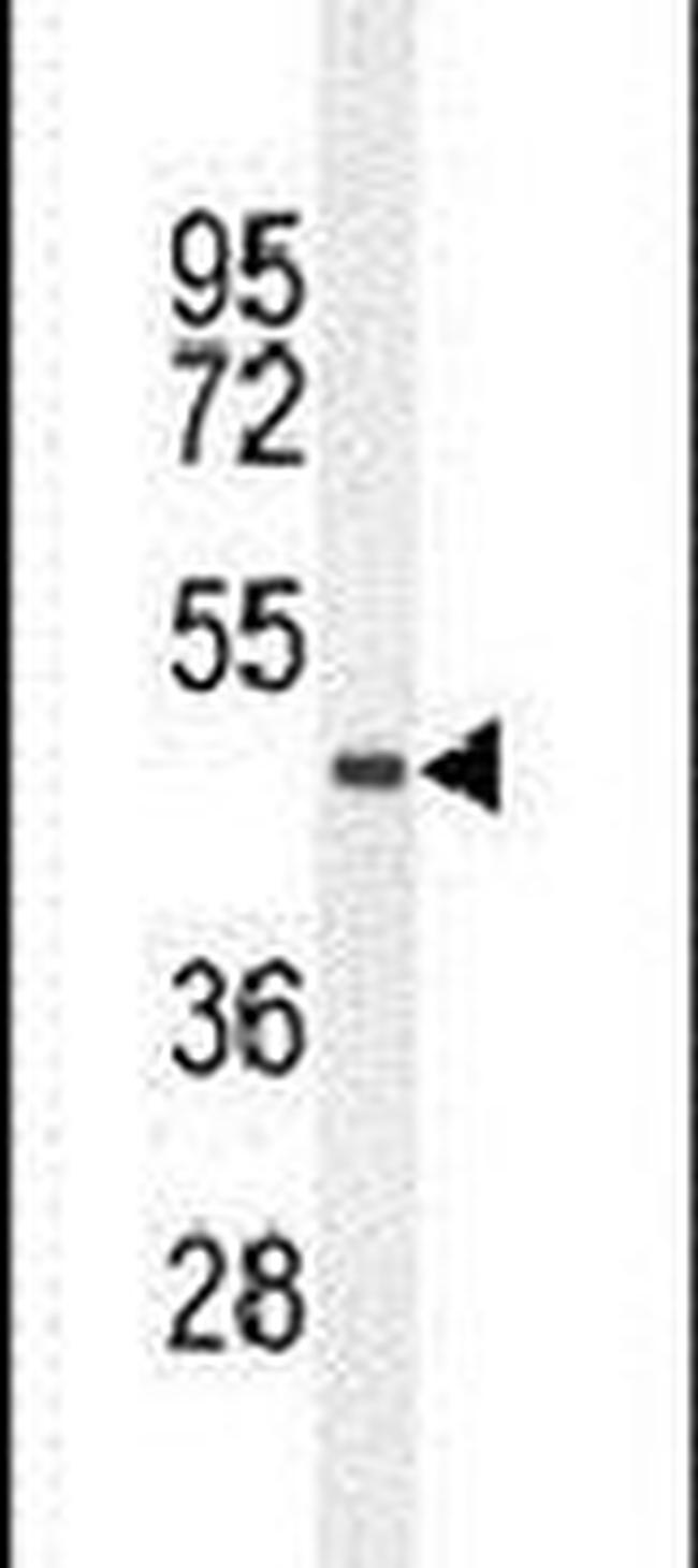TMEM229A Antibody in Western Blot (WB)