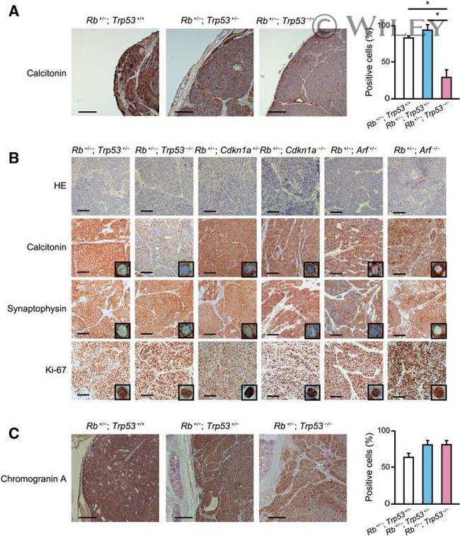 CGRP Antibody in Immunohistochemistry (PFA fixed) (IHC (PFA))