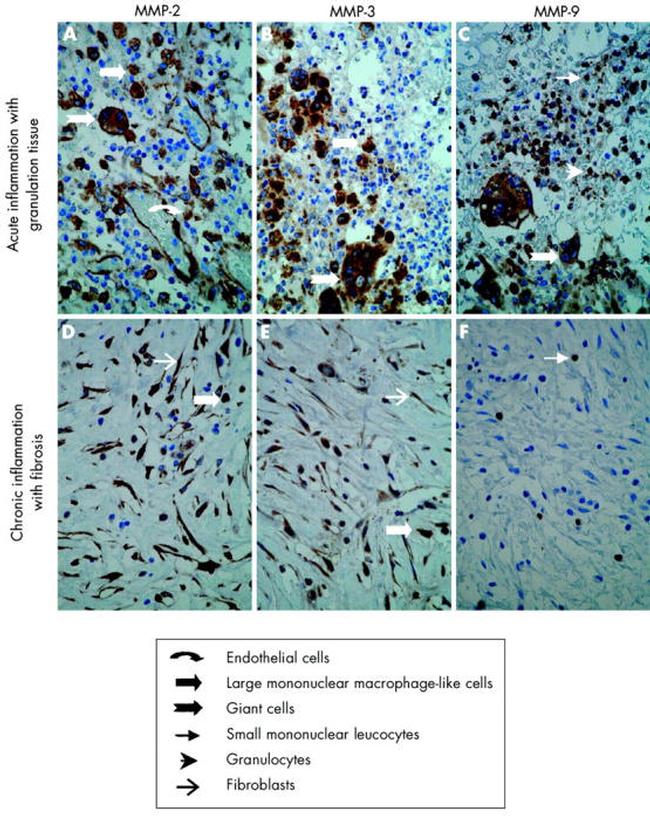 MMP9 Antibody in Immunohistochemistry (IHC)