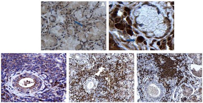 CLEC4C Antibody in Immunohistochemistry (IHC)