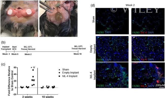 F4/80 Antibody in Immunocytochemistry (ICC/IF)