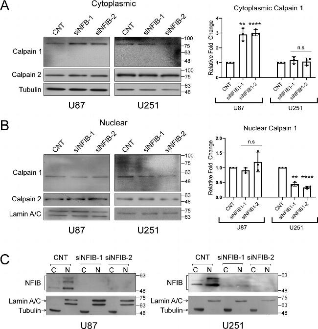 Lamin A+C Monoclonal Antibody [JOL2]