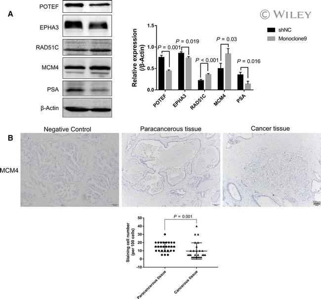 POTEF Antibody in Western Blot (WB)