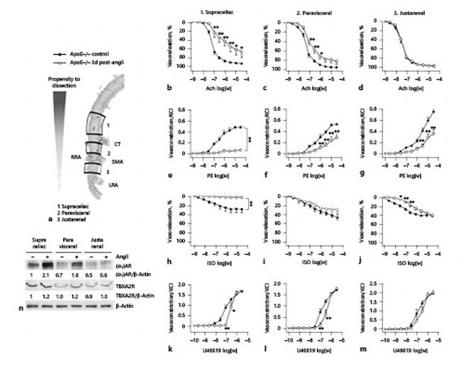TBXA2R Antibody in Western Blot (WB)