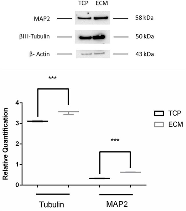 MAP2 Monoclonal Antibody (M13) (13-1500)