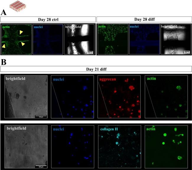 Collagen II Antibody in Immunocytochemistry (ICC/IF)