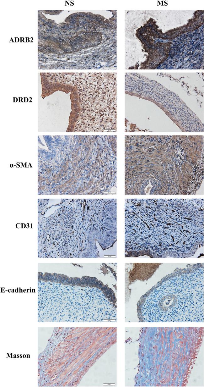 DRD2 Antibody in Immunohistochemistry (IHC)