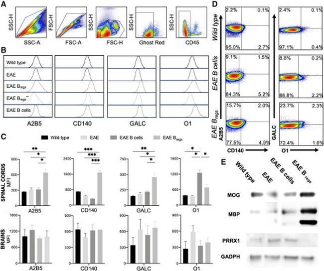PRRX1 Antibody in Western Blot (WB)
