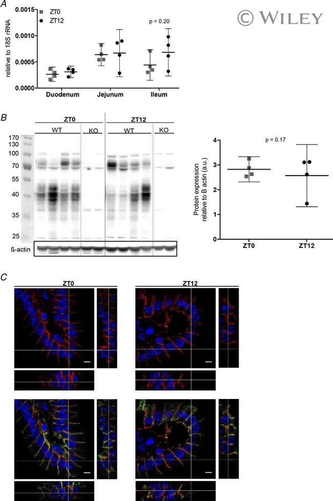 E-cadherin Antibody in Immunocytochemistry (ICC/IF)