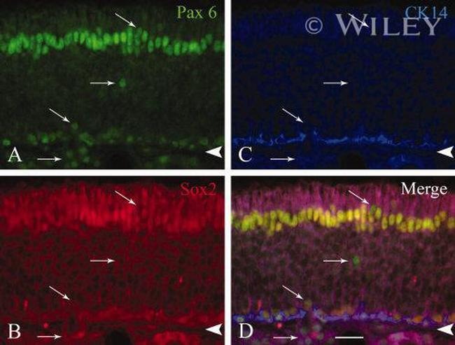 Fluorescein/Oregon Green Antibody in Immunohistochemistry, Immunocytochemistry (IHC, ICC/IF)