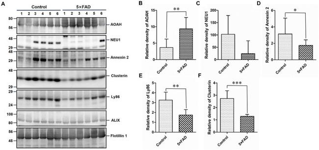 AOAH Antibody in Western Blot (WB)