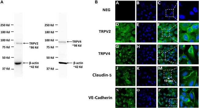TRPV2 Antibody in Immunocytochemistry (ICC/IF)