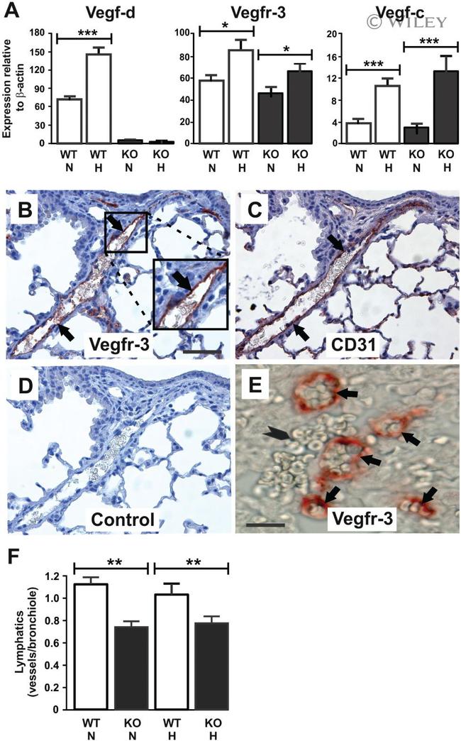 VEGF Receptor 3 Antibody in Immunohistochemistry (IHC)