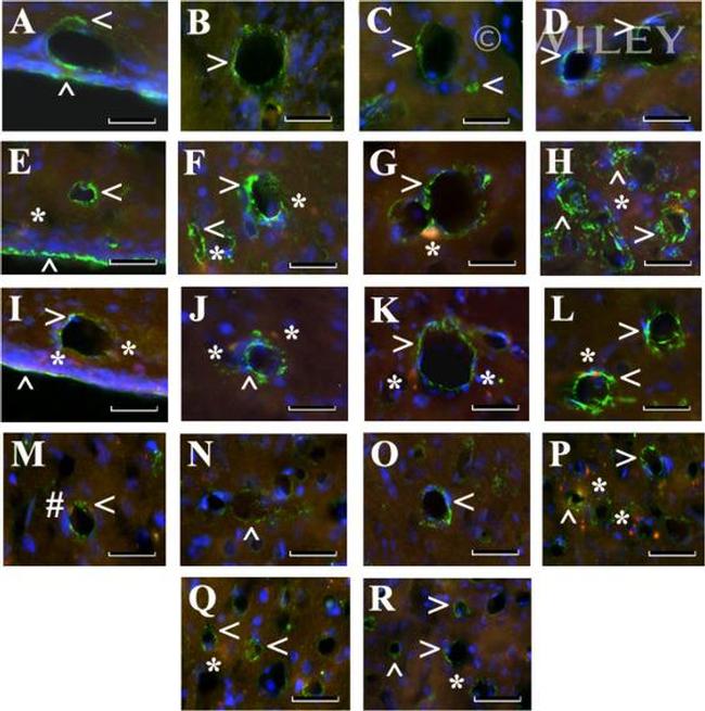 Beclin 1 Antibody in Immunohistochemistry (IHC)
